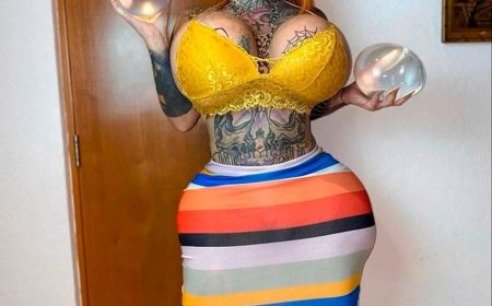 Influencer com seios do peso de  10kg morre de forma misteriosa