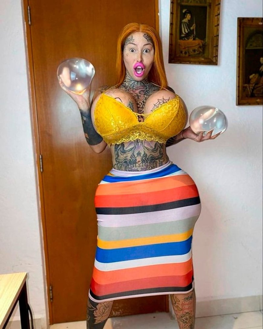 Influencer com seios do peso de  10kg morre de forma misteriosa
